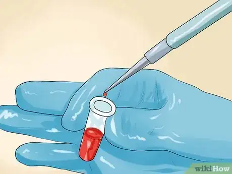 Image titled Diagnose Lynch Syndrome Step 8