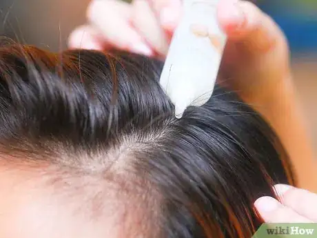 Image titled Prevent Head Lice Step 4