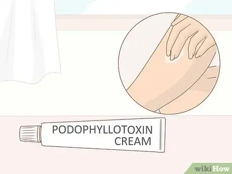 Image titled Prevent Molluscum (Molluscum Contagiosum) Step 12