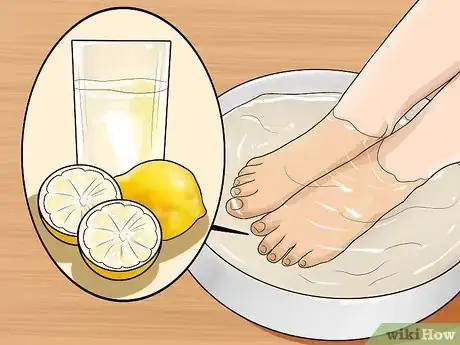Image titled Get Rid of Yellow Toenails Step 13