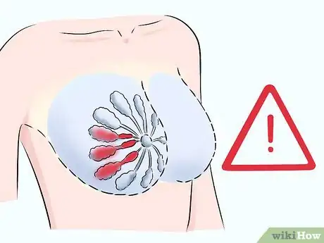 Image titled Gradually Stop Breastfeeding Step 13