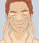 Exfoliate Your Face
