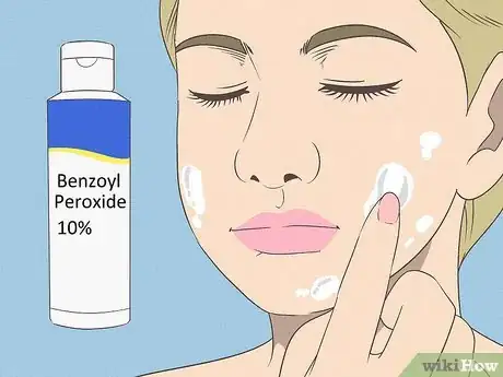 Image titled Get Rid of Acne if You Have Fair Skin Step 3