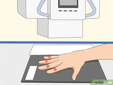 Image titled Diagnose Arthritis Step 11