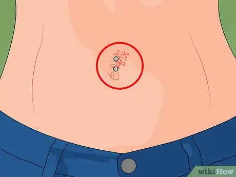 Image titled Care for a New Navel Piercing Step 14