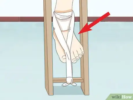 Image titled Make a Traction Splint for a Fractured Femur Step 7