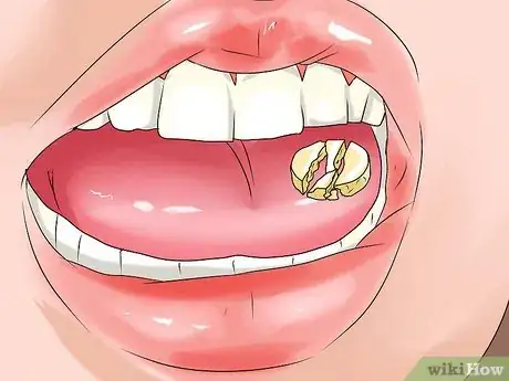 Image titled Respond to a Heart Attack Step 12