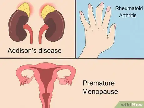 Image titled Diagnose Hashimoto's Step 2