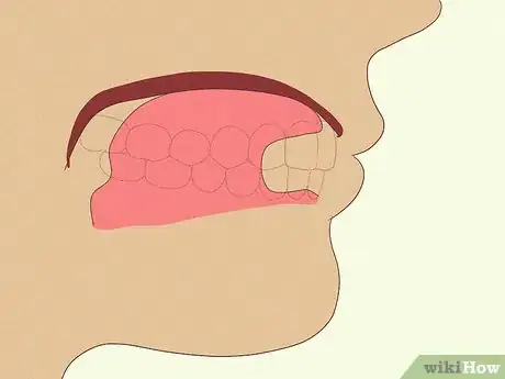 Image titled Get a Chiseled Jawline Step 6