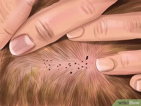 Image titled Identify Canine Flea Problems Step 2