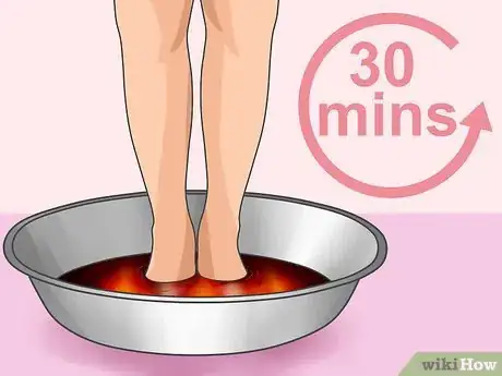 Image titled Prevent Foot Odor Step 7