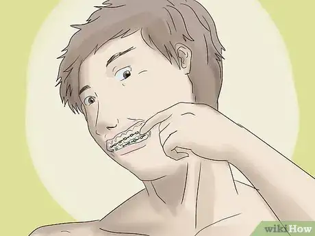 Image titled Make Out With Braces Step 1
