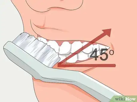 Image titled Avoid Tooth Decay Step 4