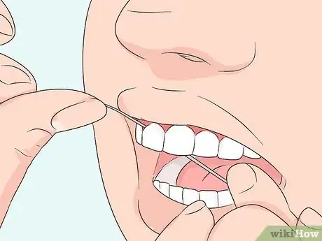 Image titled Prevent Tartar Step 2
