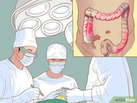 Image titled Live With Inflammatory Bowel Disease Step 5