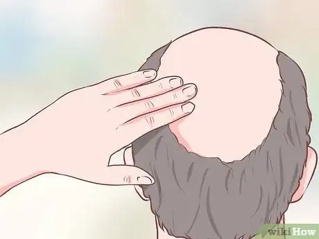 Image titled Help Someone Recover From a Kidney Transplant Step 5