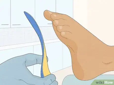 Image titled Know if You Have Neuropathy in Your Feet Step 9