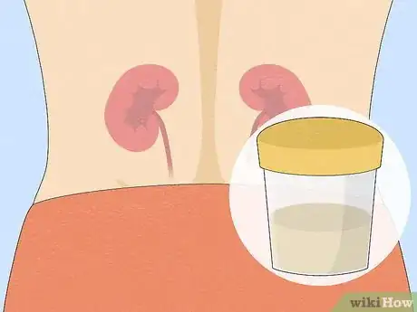 Image titled Prevent Kidney Damage with Type 1 Diabetes Step 8