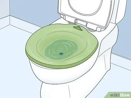 Image titled Treat Pregnancy Hemorrhoids at Home Step 2