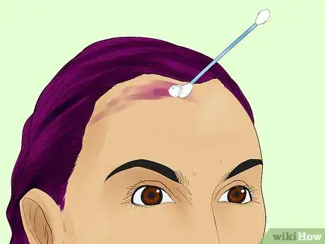 Image titled Remove Hair Dye from Your Scalp Step 11
