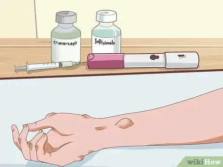 Image titled Handle a Rheumatoid Arthritis Skin Problem Step 7