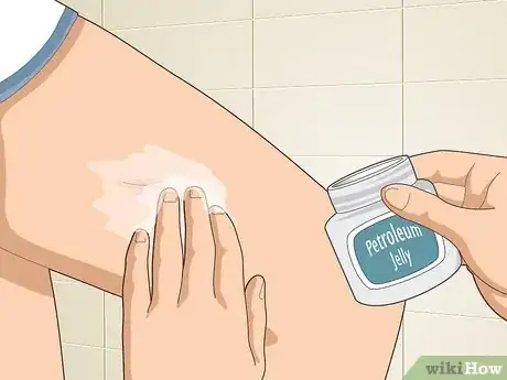 Image titled Reduce Scars Naturally Step 9