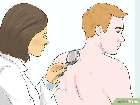 Image titled Know if You Need a Prescription Acne Treatment Step 8