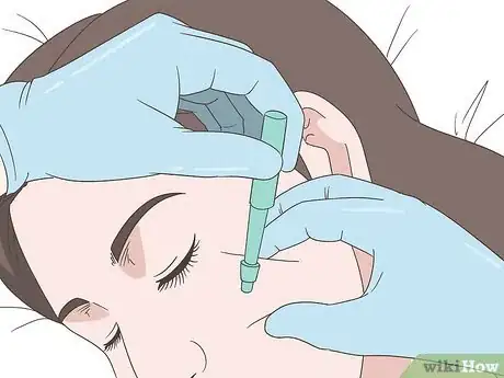 Image titled Diagnose and Treat Facial Vitiligo Step 5