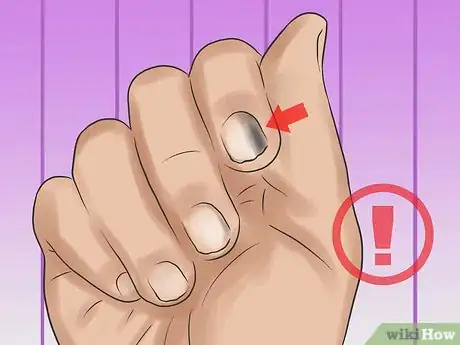 Image titled Keep Your Nails Healthy Step 17