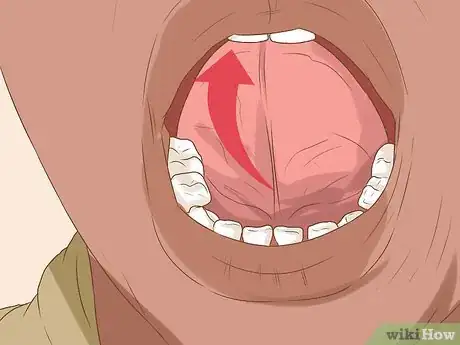 Image titled Heal a Bitten Tongue Step 2