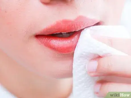 Image titled Lighten Dark Lips Step 4