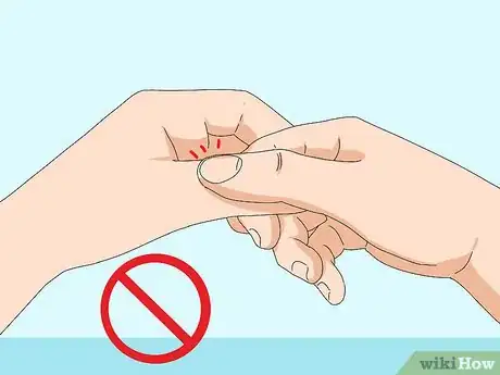 Image titled Wrap a Sprained Thumb Step 13