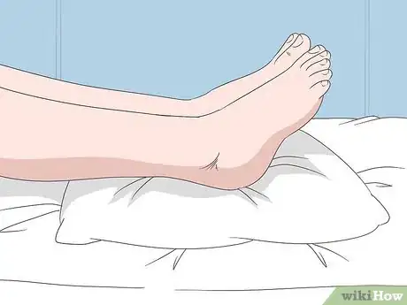 Image titled Wear a Dorsal Night Splint Step 11