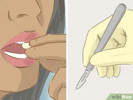 Image titled Prevent Myoma Step 16