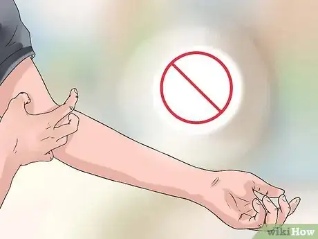 Image titled Treat Winter Eczema Step 5