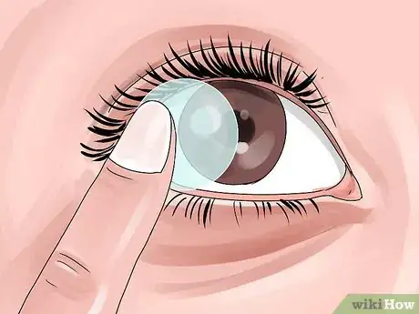 Image titled Keep Your Eyes Healthy when Using Decorative Lenses Step 12