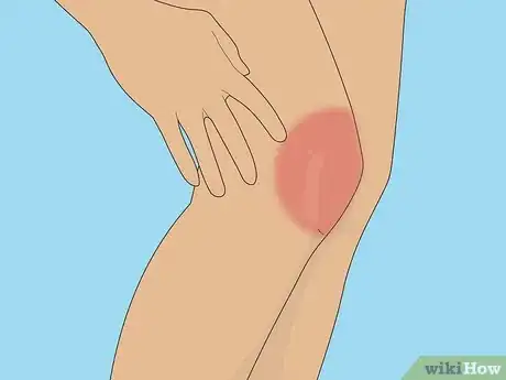 Image titled Strengten Your Quads Without Hurting Your Knees Step 1