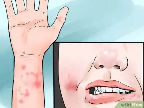 Image titled Use Acai Berry for Weight Loss Step 8