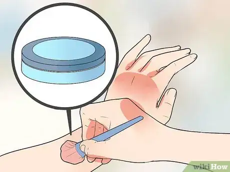 Image titled Camouflage a Scar Step 7