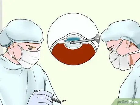 Image titled Prevent Development of Cataracts Step 14