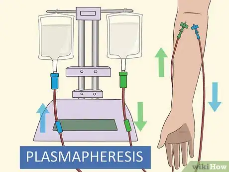 Image titled Treat Myasthenia Gravis Step 6