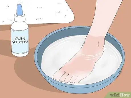 Image titled Heal a Bruised Toe Step 9