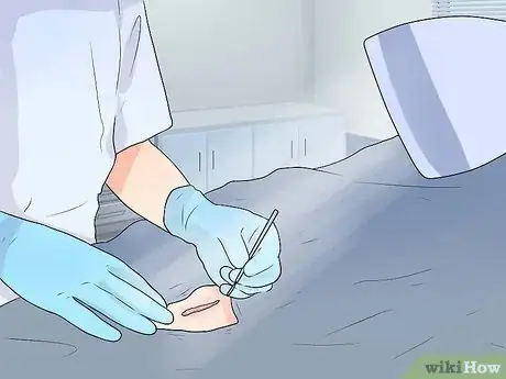 Image titled Prevent Keloid and Hypertrophic Scars Step 4