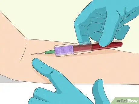 Image titled Determine the Cause of Hair Loss Step 5