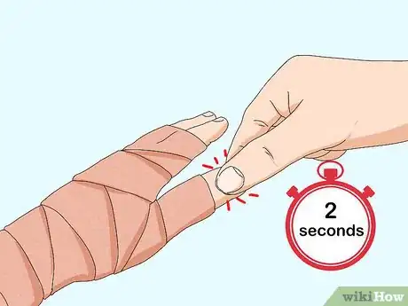 Image titled Wrap a Sprained Thumb Step 10