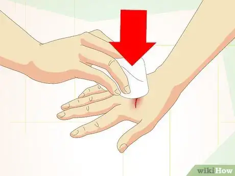 Image titled Care for Superficial Wounds Step 3