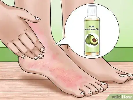 Image titled Apply Avocado Oil Step 6