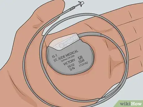 Image titled Treat Multiple System Atrophy (MSA) Step 14