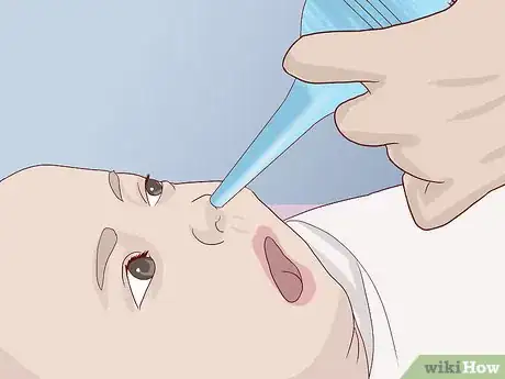 Image titled Use a Bulb Syringe on a Baby Step 10