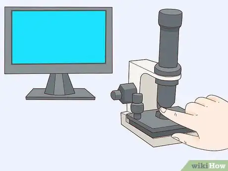 Image titled Treat Raynaud's Syndrome Step 11